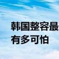 韩国整容最自然最成功的自然人 整容后遗症有多可怕