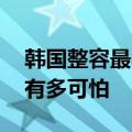 韩国整容最自然最成功的自然人 整容后遗症有多可怕